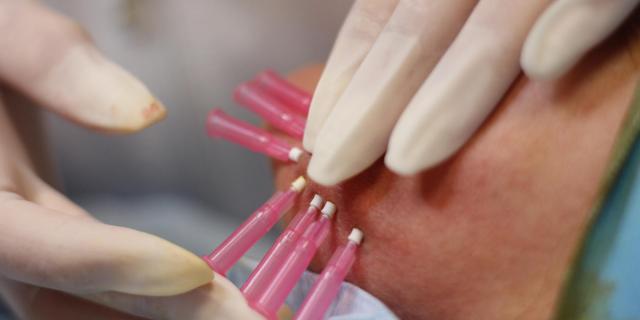 Jak probíhá prime lifting mezonitěmi?