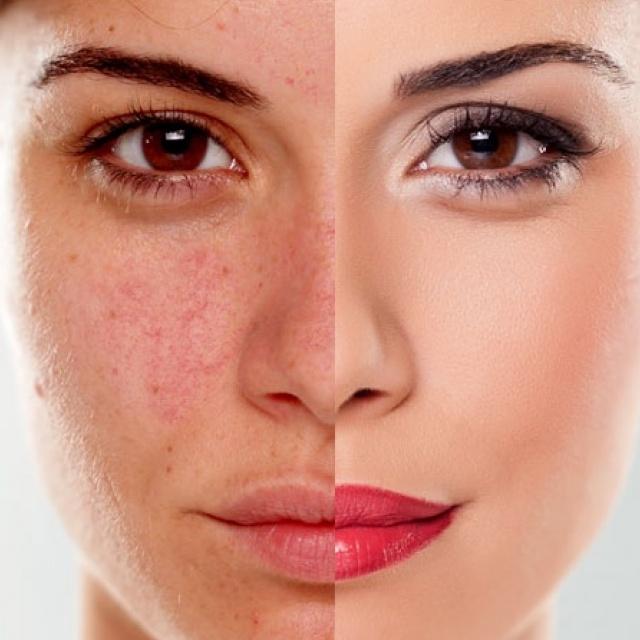 Oddělení dermatologie