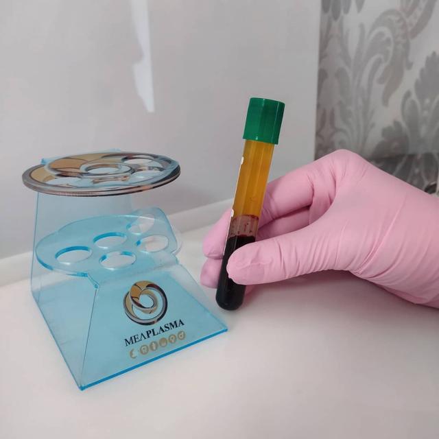 Krevní plazma = zázrak medicíny